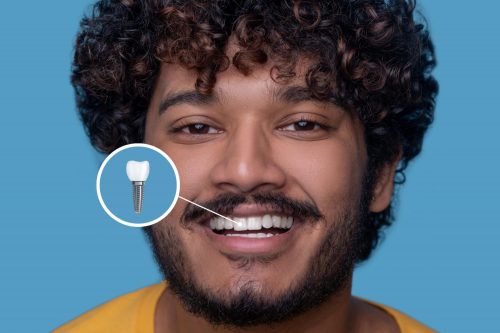 dental implants in Spokane WA