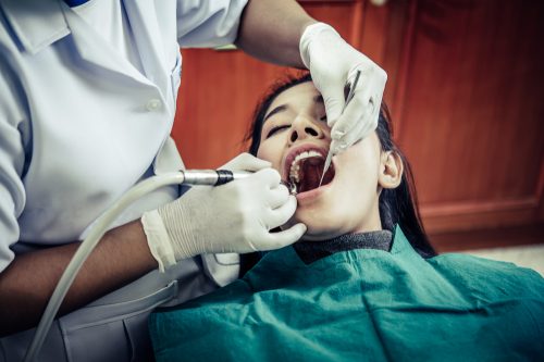 teeth cleaning
